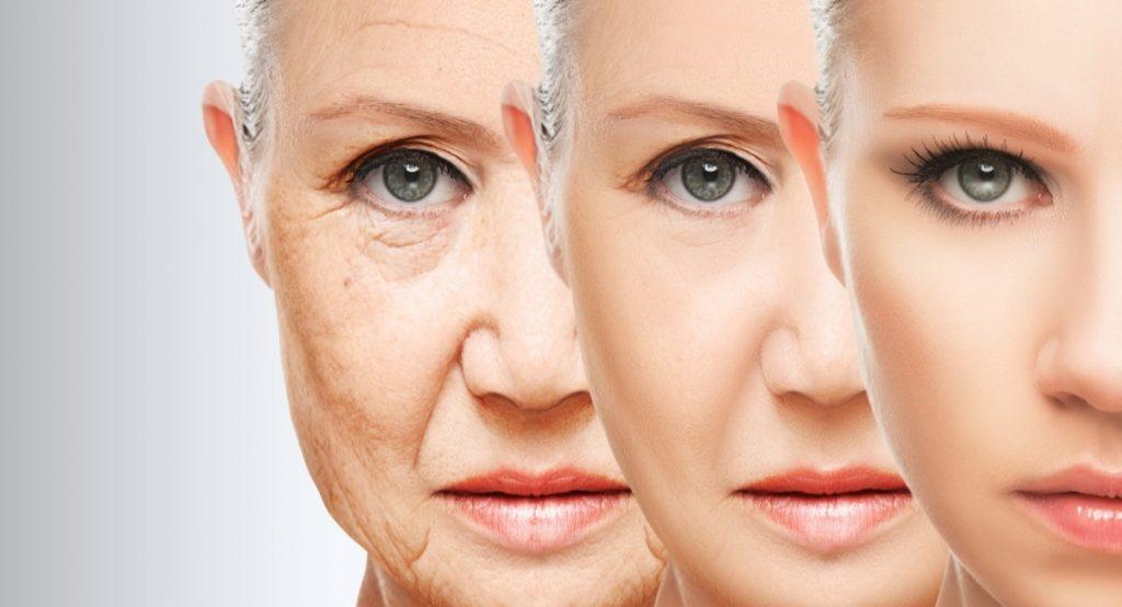 So You’re Having A Facelift. Here’s What To Expect Post-Op